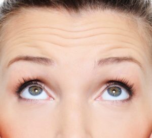 forehead wrinkles