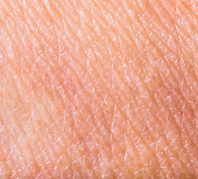 crepey skin