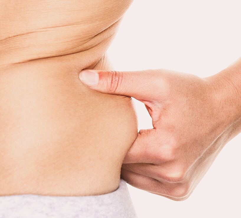 love handles