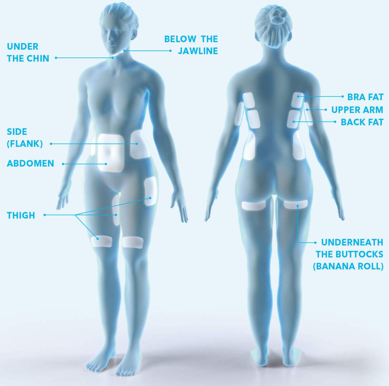 CoolSculpting treatment areas include under the chin, below the jawline, the abdomen, obliques, thighs, bra fat, upper arm, back fat, and underneath the buttock