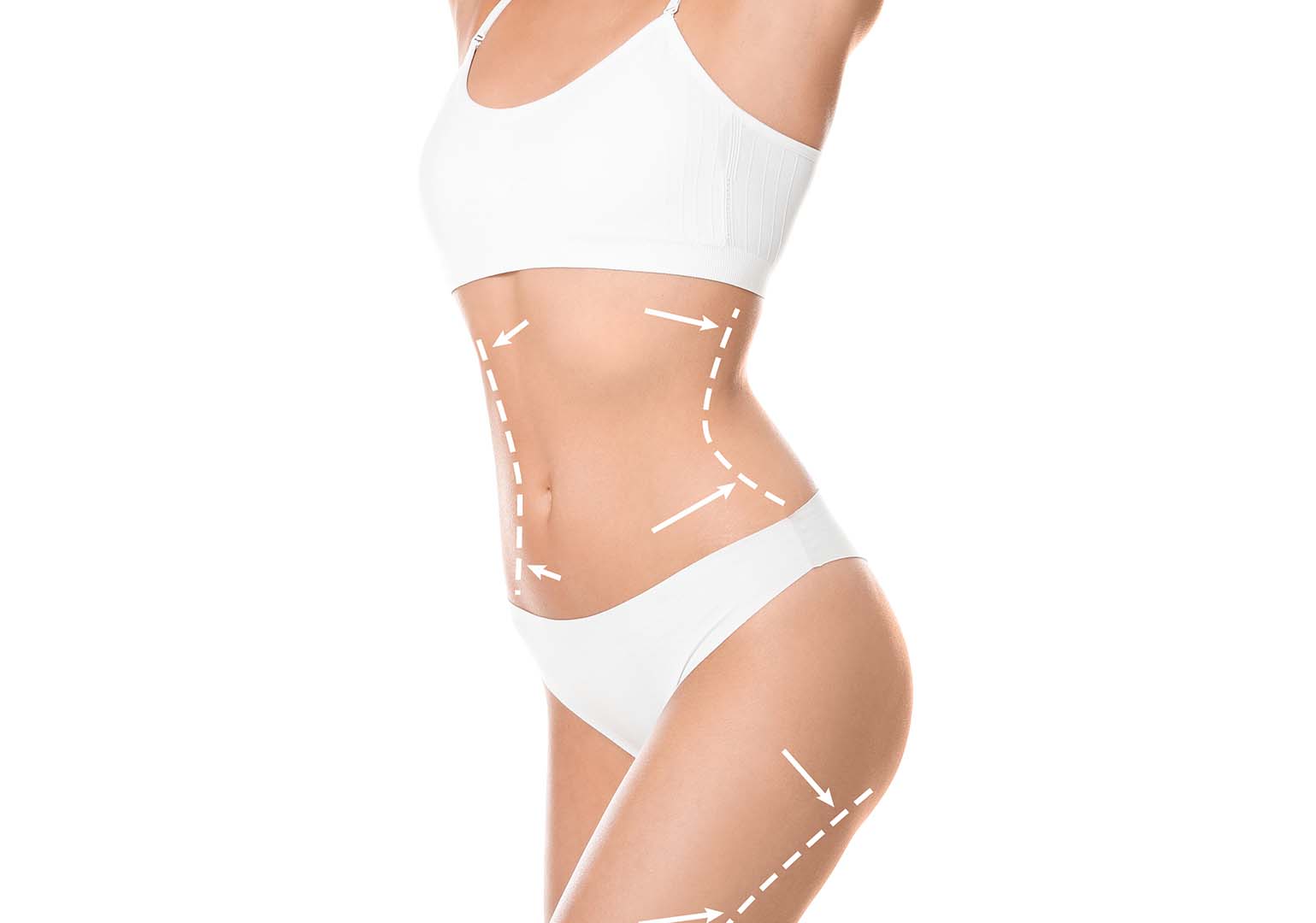coolsculpting treatment center